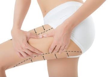 3D Thighs Trim